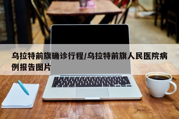 天津绿篱行情(天津普林股票费用预测最新)